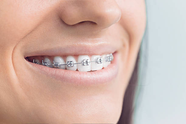 Best Wisdom Tooth Removal  in Gleneagle, CO