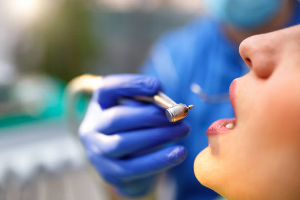 Best Teeth Whitening  in Gleneagle, CO